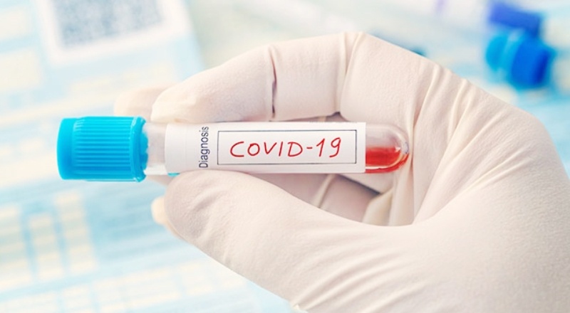 Bilim insanları, bazı kan gruplarının Covid-19'a karşı daha dirençli olduğunu tespit etti