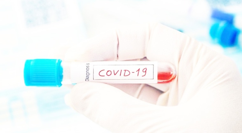 Covid-19 aşısında KDV oranı yüzde 1 oldu