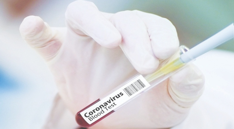 DSÖ: Covid-19 aşı sonuçları yıl sonunda ortaya çıkacak
