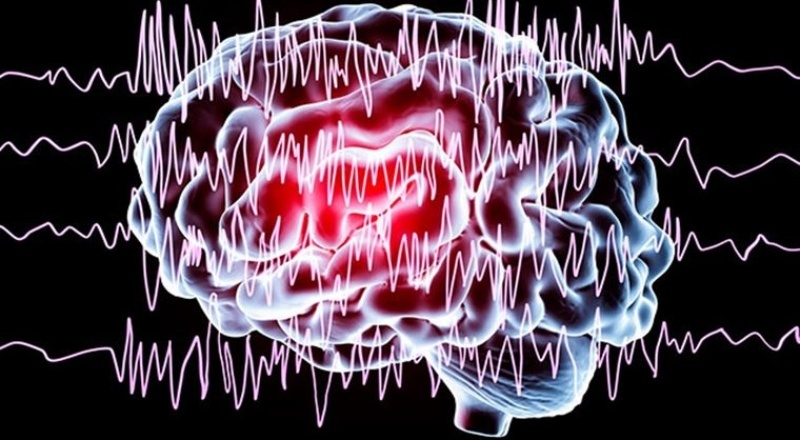 Epilepsi nöbetini önceden tespit eden bileklik geliştirildi