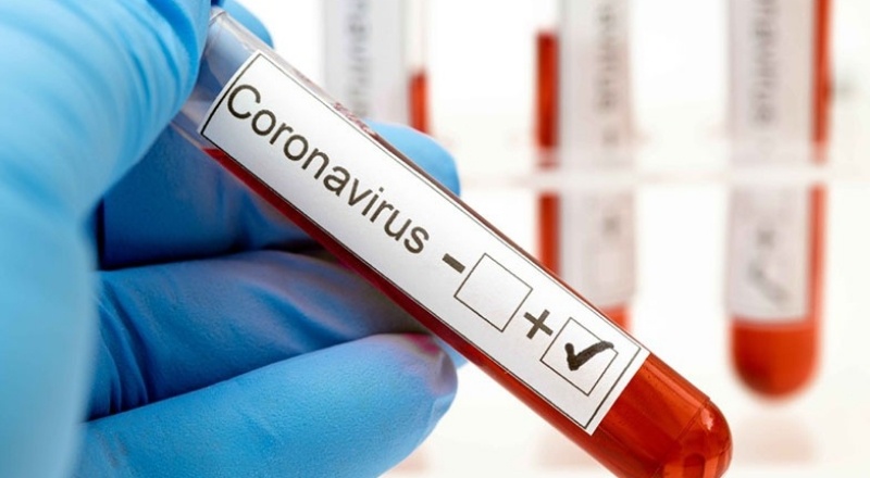 Prof. Dr. Akın: Koronavirüs salgınında toplumsal bağışıklık kazanılmadığı için vaka sayısı yüksek