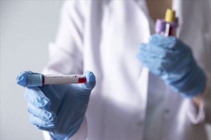 Türkiye'de korona virüsü testi yapılabilen 25 hastane var
